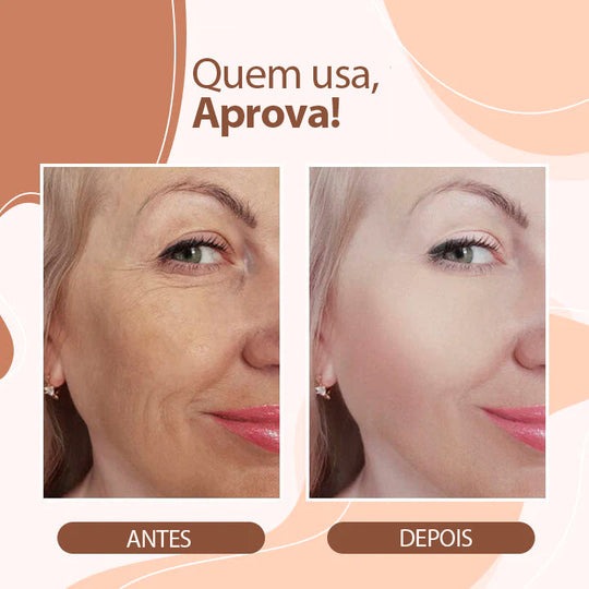 Revelare Derol - Hidratante Premium para Pele Sem Sinais